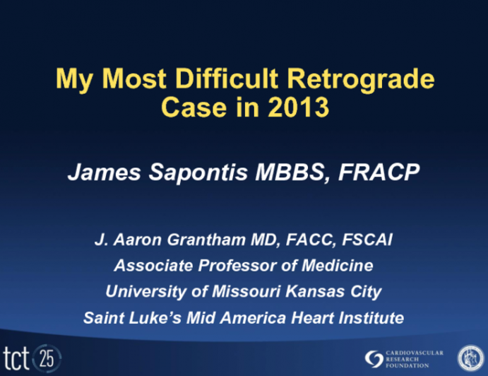 Case Presentation 2: My Most Difficult Retrograde Approach Case in 2013