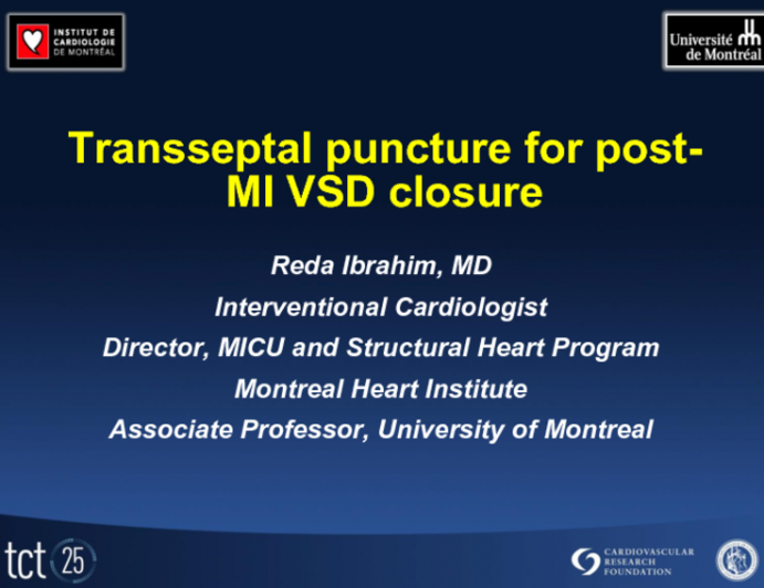 For Post-MI VSD Closure