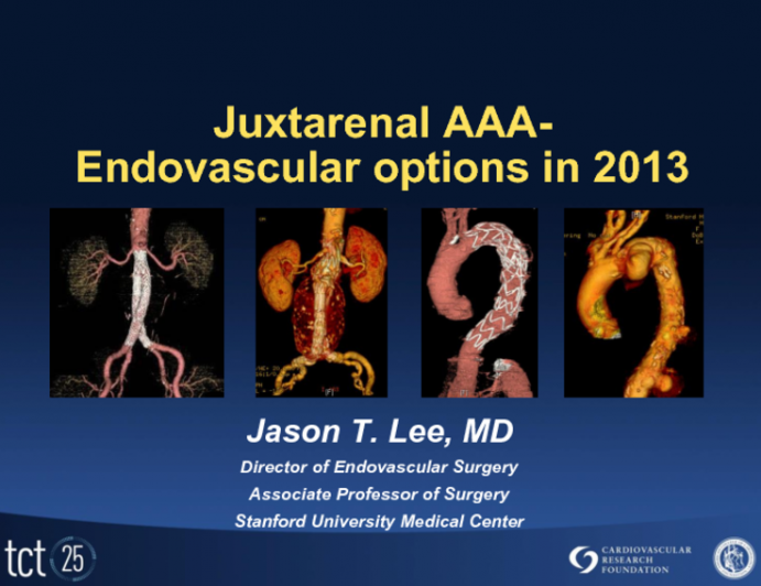 Treatment of Juxtarenal and Pararenal AAA: Endovascular Options in 2013