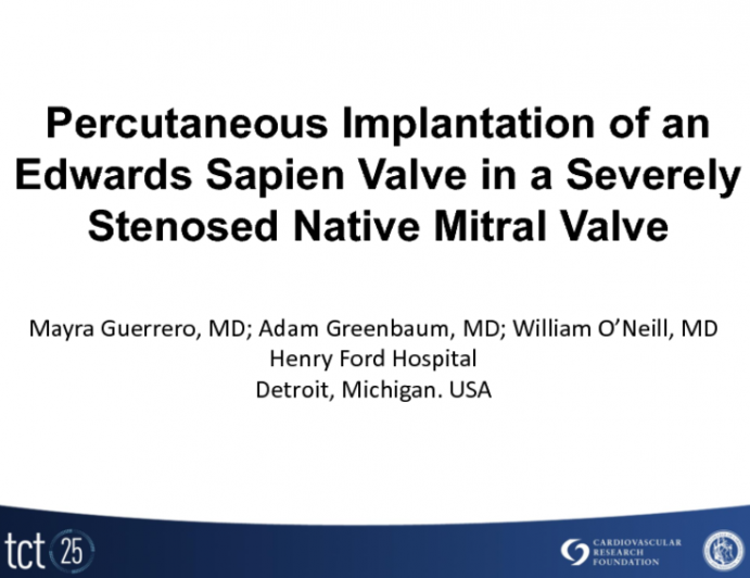 Case Vignette: Treatment of Calcific Mitral Stenosis with a Balloon Expandable Transcatheter Bioprostheses