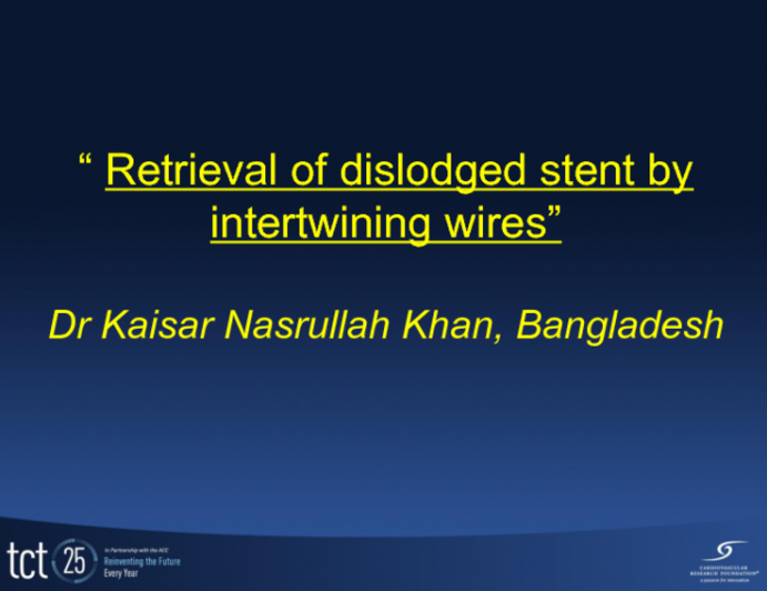 Case #2: Retrieval of a Dislodged Stent by Intertwining Wires