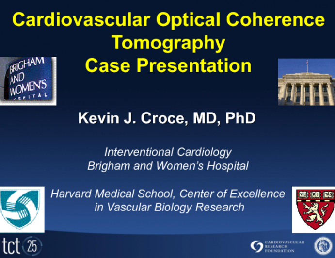 Case #4: OCT Case