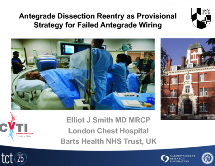 Case 1: Antegrade Dissection Reentry as Provisional Strategy for Failed Antegrade Wiring