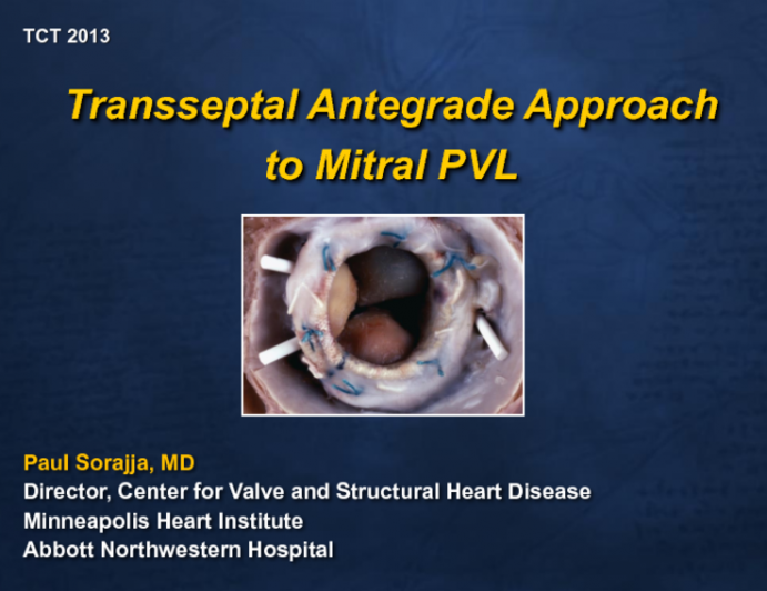 Case I:  Transseptal Antegrade Approach to a Mitral Valve PVL