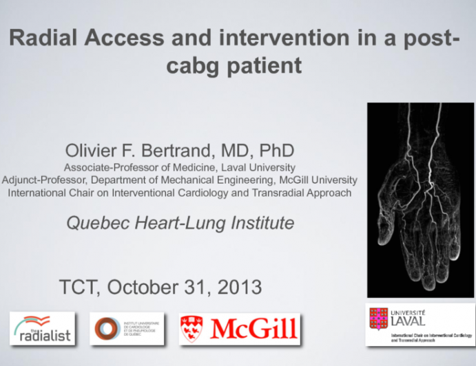 Case 3: Radial Access and Intervention in the Post-CABG Patient