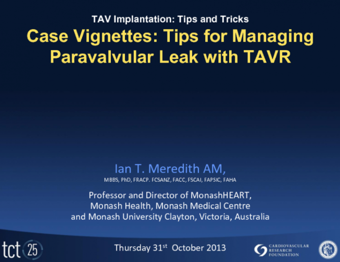 Case Vignettes: Tips and Tricks for Managing Paravalvular Leak After TAVR