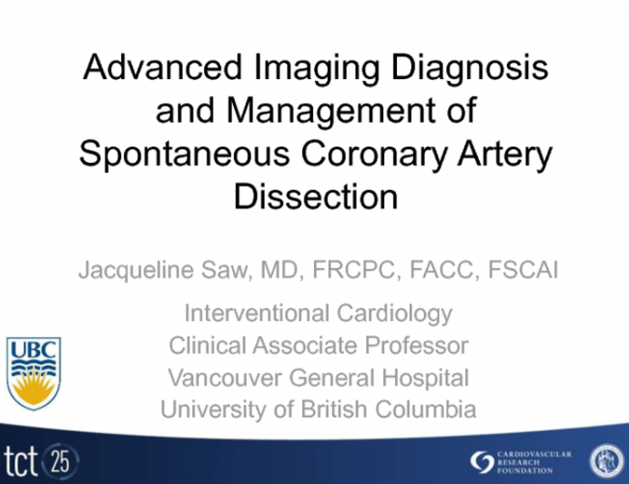 Advanced Imaging Diagnosis and Management of Spontaneous Coronary Artery Dissection