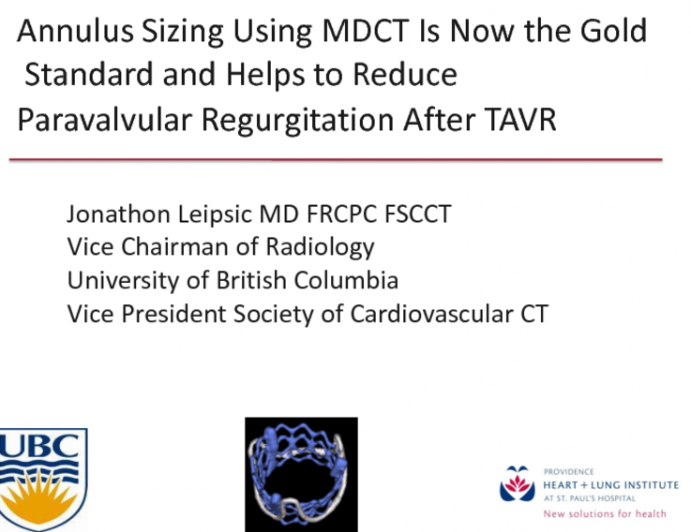 Annulus Sizing Using MSCT Is Now the Gold Standard and Helps to Reduce Paravalvular Regurgitation After TAVR