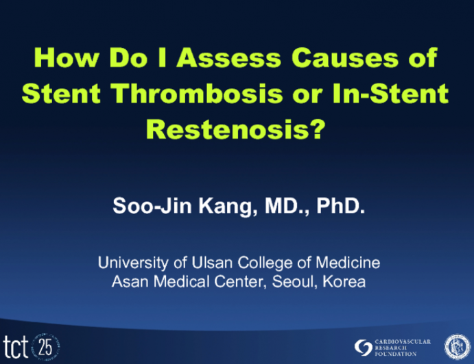 How Do I Assess Causes of Stent Thrombosis or In-Stent Restenosis?