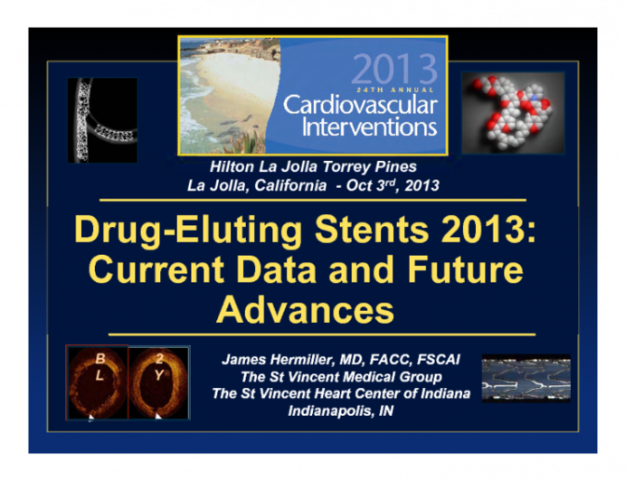 Drug-eluting Stents 2013: Current Data, Future Advances