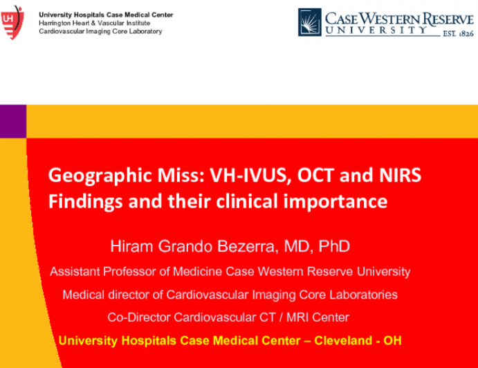 Geographic Miss: VH-IVUS, OCT and NIRS Findings and Their Clinical Importance