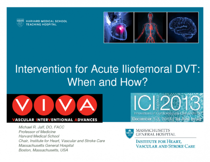 Intervention for Acute Iliofemoral DVT: When and How?