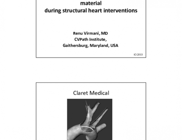 Etio-Histopathology of Captured Embolic Material during Structural Heart Interventions