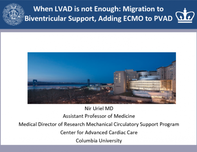 When LVAD is not Enough: Migration to Biventricular Support, Adding ECMO to PVAD