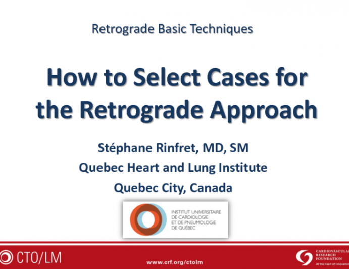 How to Select Cases for the Retrograde Approach