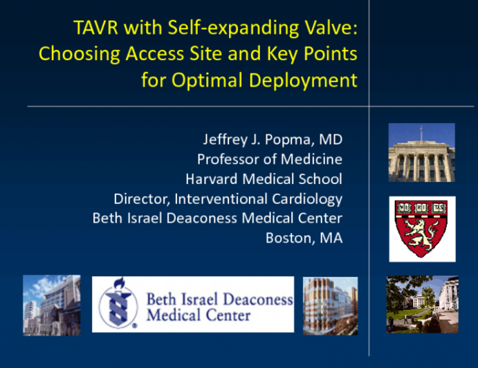 TAVR with Self-expanding Valve: Choosing Access Site and Key Points for Optimal Deployment