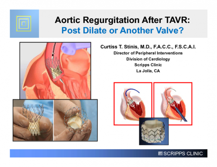 Aortic Regurgitation After TAVR: Post Dilate or Another Valve?