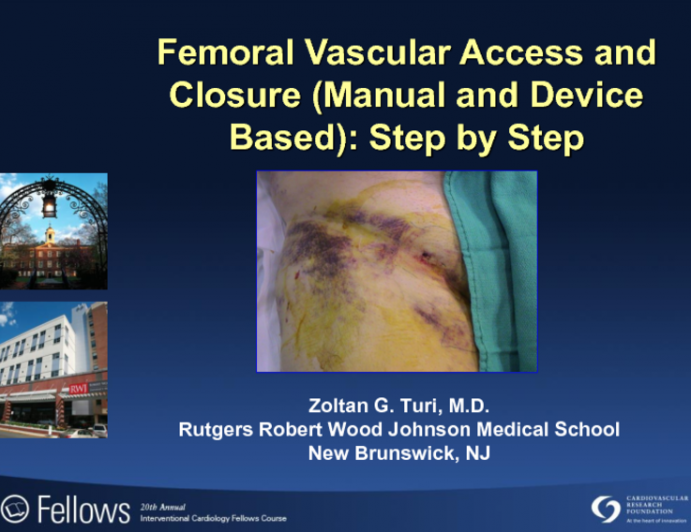 Femoral Vascular Access and Closure (Manual and Device Based): Step-by-Step