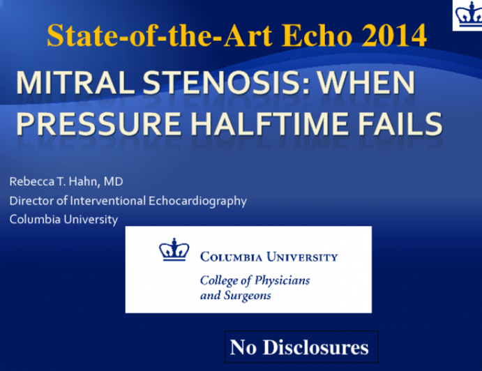 Mitral Stenosis: When Pressure Halftime Fails