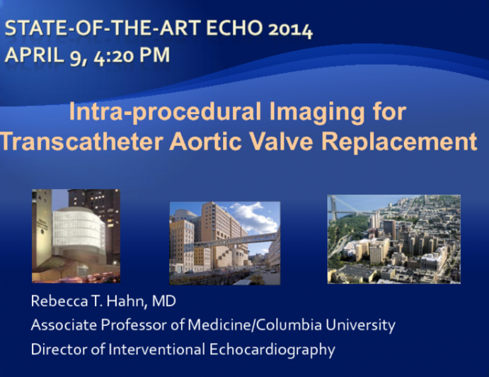 Intra-procedural Imaging for Transcatheter Aortic Valve Replacement