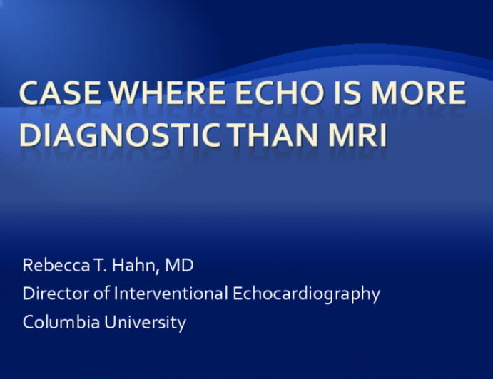 Case Where Echo is More Diagnostic Than MRI