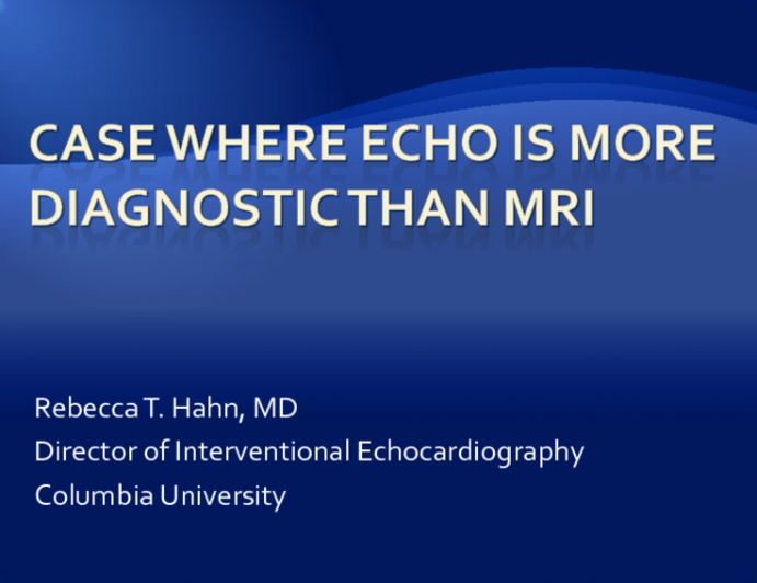 Case Where Echo is More Diagnostic than MRI(2)