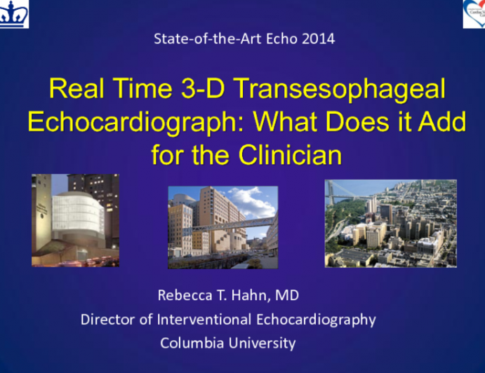 Real Time 3-D Transesophageal Echocardiograph: What Does it Add for the Clinician