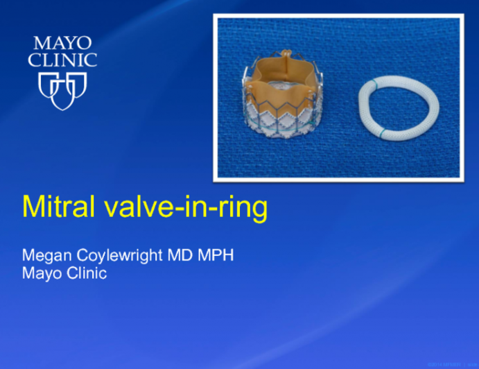 Transcatheter Mitral Valve-in-Ring