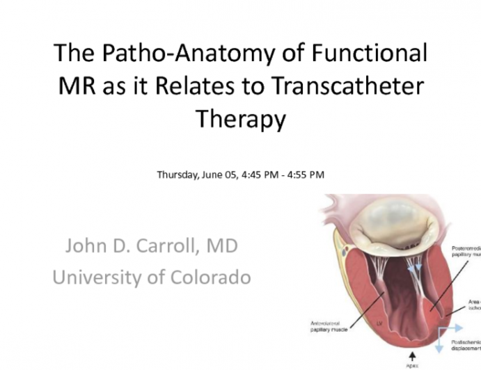 The Pathoanatomy of Functional MR as it Relates to Transcatheter Therapy