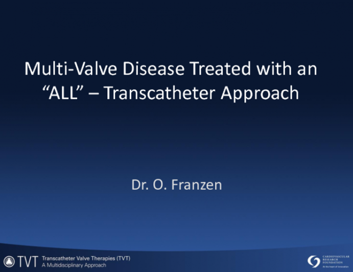 Multi-Valve Disease Treated with an ALL Transcatheter Approach
