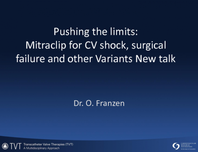 Pushing the Limits: MitraClip for CV shock, Surgical Failure and Other Variants New Talk