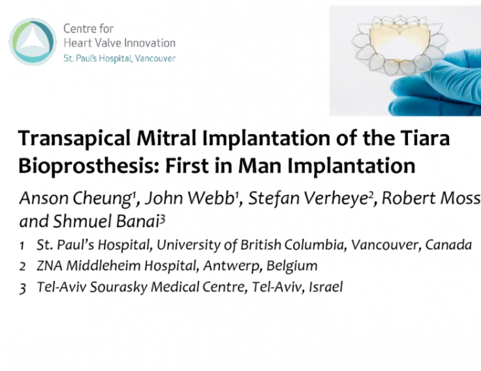 Transcatheter Mitral Valve Replacement: Neovasc Tiara Taped Case Study