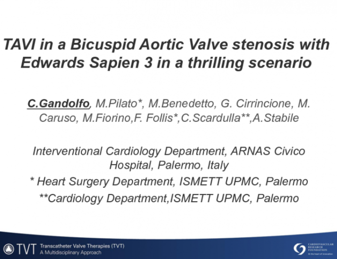 TAVI in A Bicuspid Aortic Valve Stenosis With Edwards Sapien 3 In A Thrilling Scenario