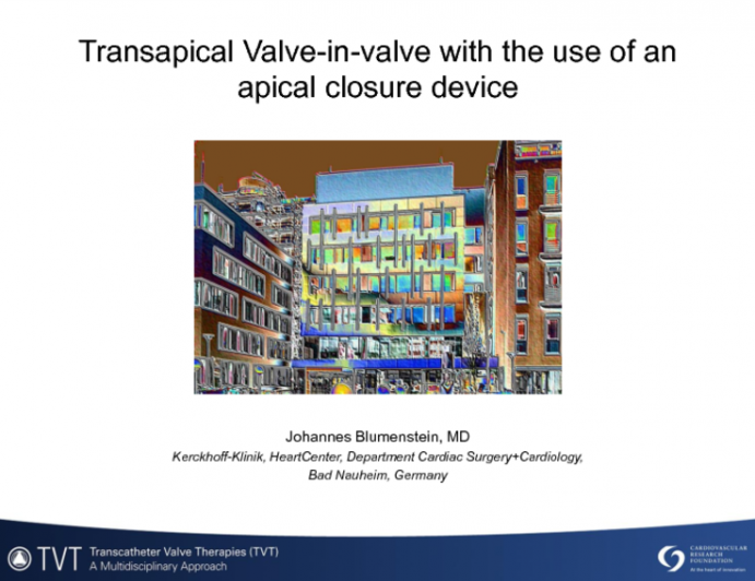 Transapical Valve-in-valve with the Use of an Apical Closure Device