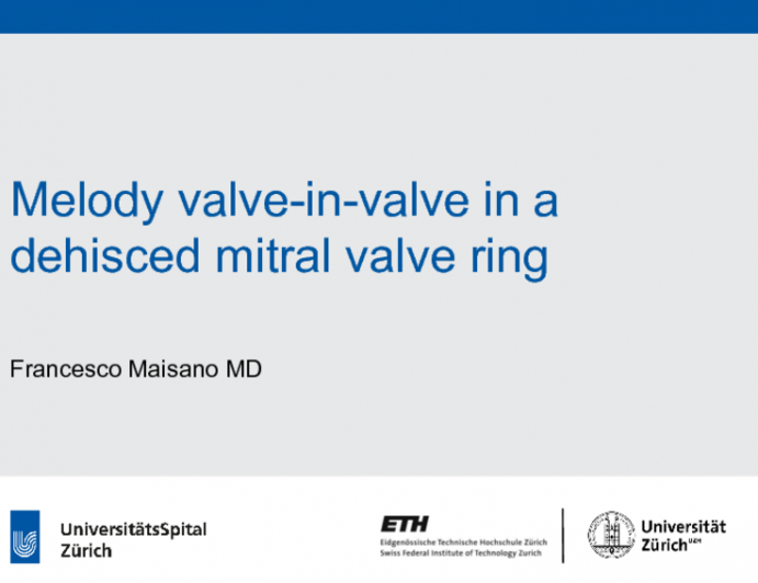 Successful First-in-man Melody Transcatheter Valve Implant in a Dehisced Mitral Annuloplasty Ring