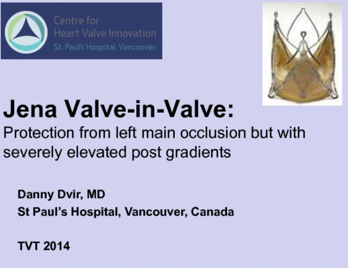 Jena Valve-in-Valve: Protection from Left Main Occlusion but with Severely Elevated Post Gradients