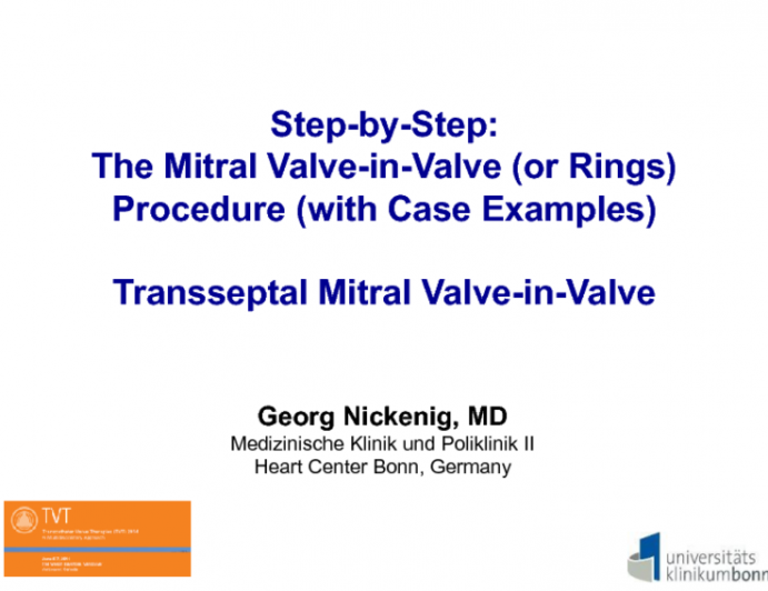 Transseptal Mitral Valve-in-Valve