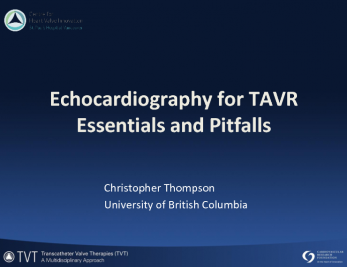 Echocardiography Essentials and Pitfalls  What EVERYONE MUST KNOW!