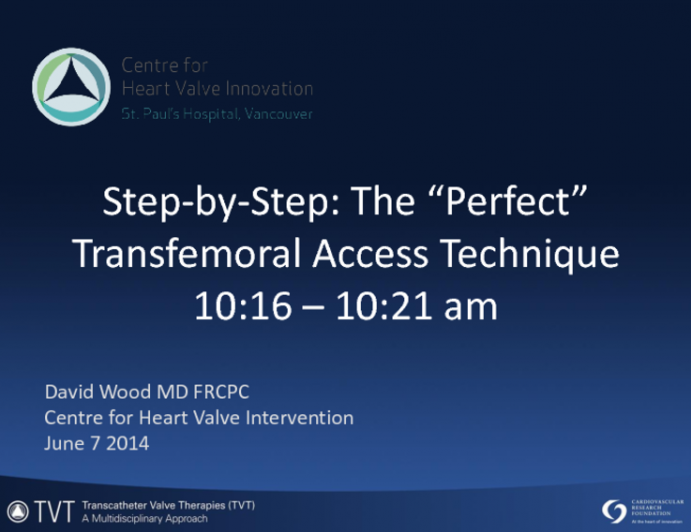 Step-by-Step: The Perfect Transfemoral Access Technique