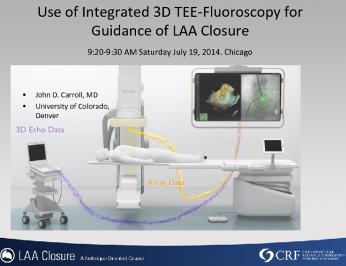 Use of Integrated 3D TEE-Fluoroscopy for Guidance of LAA Closure