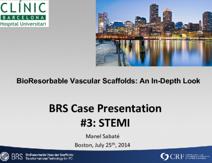 BioResorbable Vascular Scaffolds: An In-Depth Look