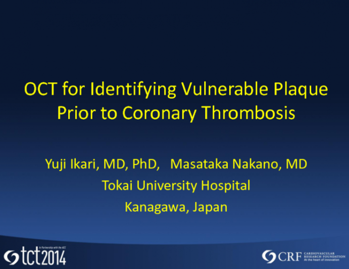 OCT for Identifying Vulnerable Plaque Prior to Coronary Thrombosis