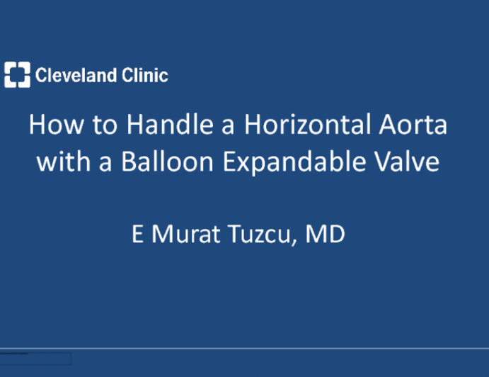 Case #7. How to Handle a Horizontal Aorta with Sapien