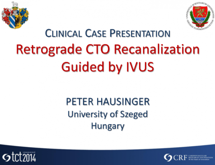 Case #4: CTO Retrograde Recanalization Guided by IVUS