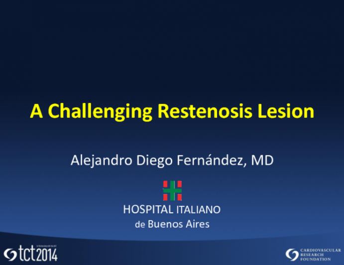 Case #2: A Challenging Restenosis Lesion