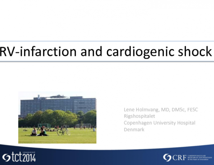 Case #3: RV Infarction After Inferior STEMI with Cardiogenic Shock