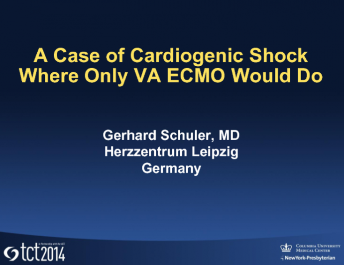 A Case of Cardiogenic Shock Where Only VA ECMO Would Do