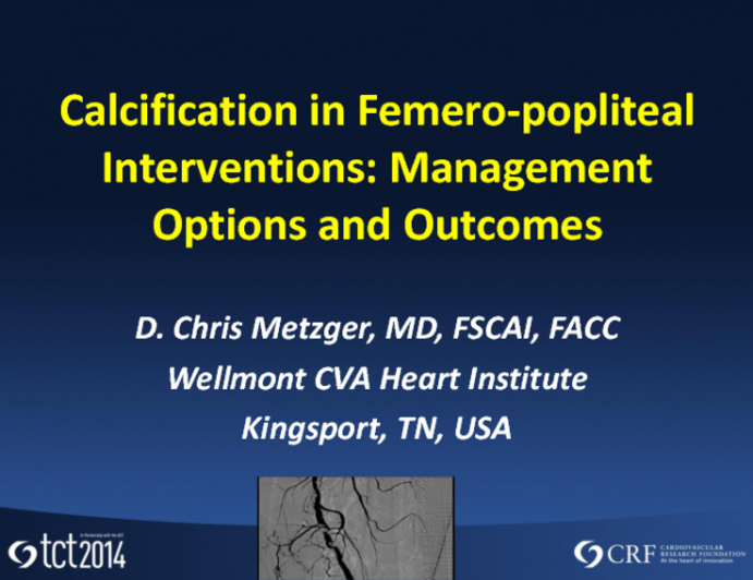 Calcification in Femoropopliteal Intervention: Management Options and Outcomes