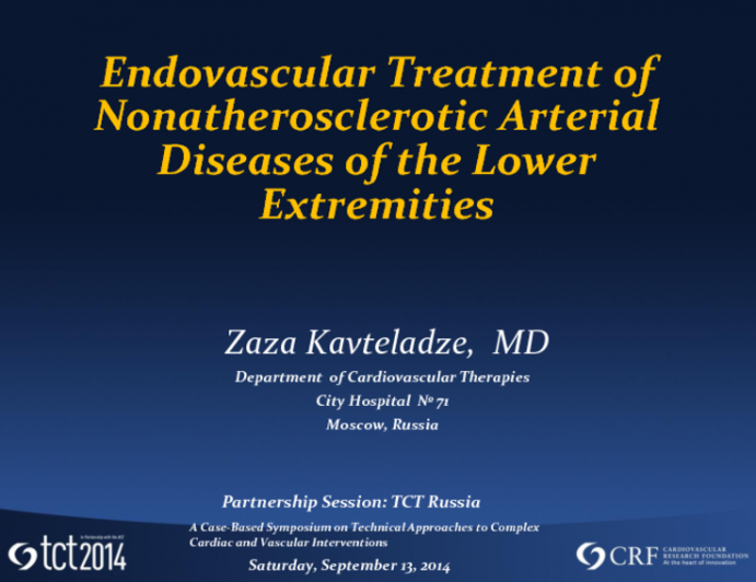 Endovascular Treatment of Nonatherosclerotic Arterial Diseases of the Lower Extremities