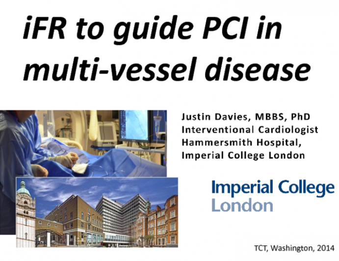 Case Reviews: iFR to Guide PCI in Diffuse and Multivessel CAD